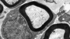 M�ster oficial de Neuroci�ncies