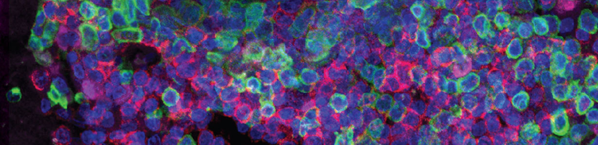 Exposici "Cells on canvas" a la Sala Teatre