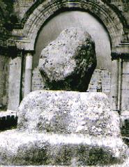 anorexia28b.jpg (14848 bytes)