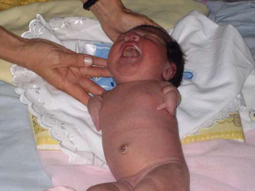 talidomida1.jpg (17689 bytes)